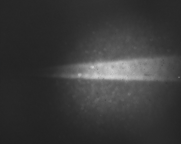 激光誘導(dǎo)熒光成像